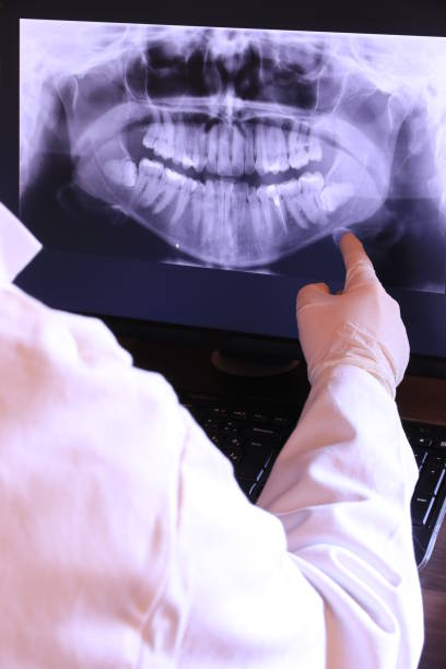Best Emergency Wisdom Tooth Extraction in Oxford, GA