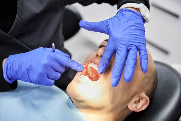 Best Broken or Chipped Tooth Repair in Oxford, GA