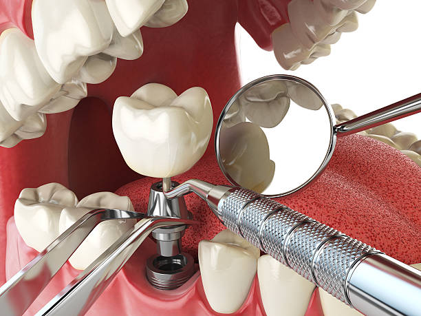 Best Walk-In Emergency Dental Services in Oxford, GA